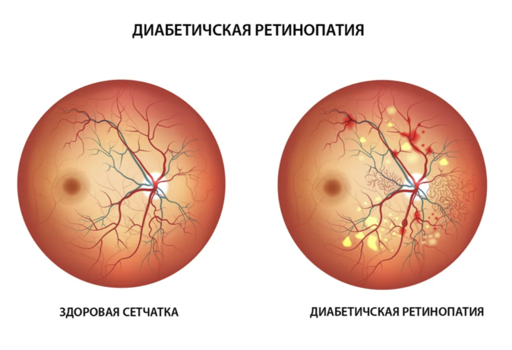 Снимок 1 (1).PNG
