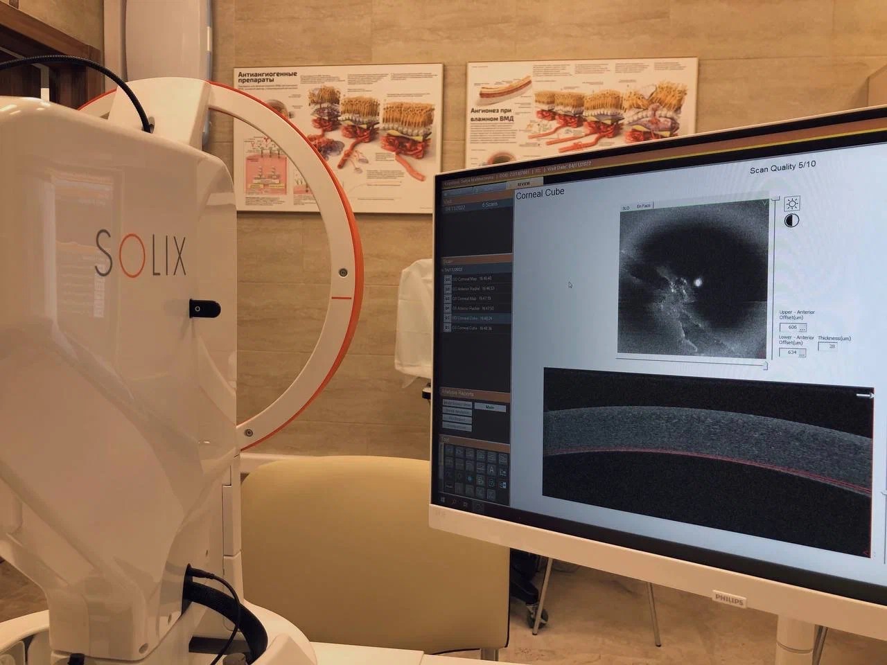 зафиксировать любую патологию роговицы с помощью фотощелевой лампы и оптического когерентного томографа (ОКТ)