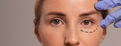 Эстетическая офтальмология