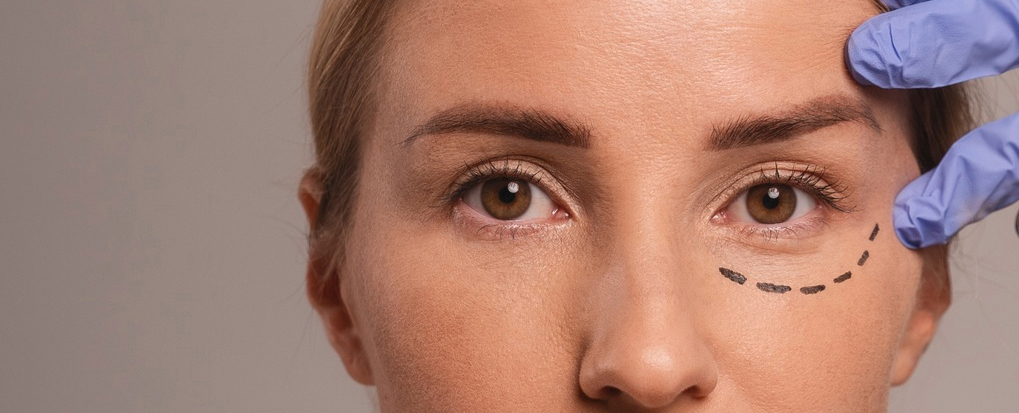 Фон - Коррекции возрастных и функциональных изменений кожи век Jett Plasma Lift Medical