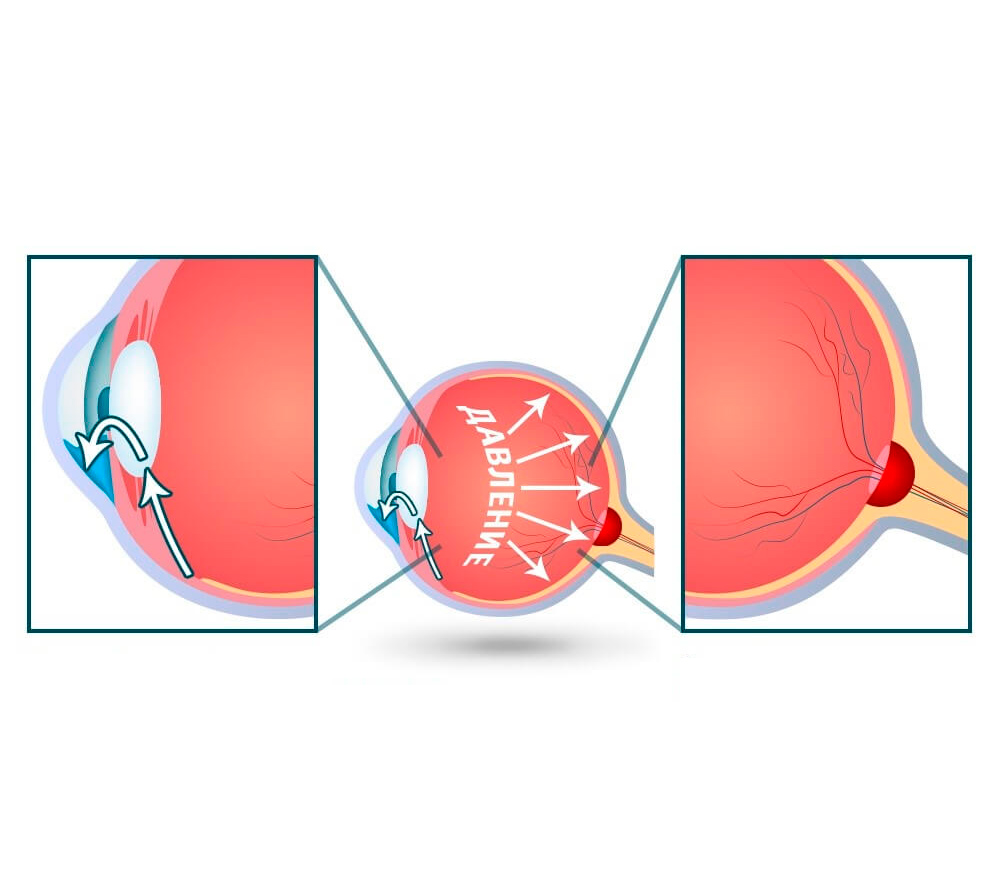 Описание картинки