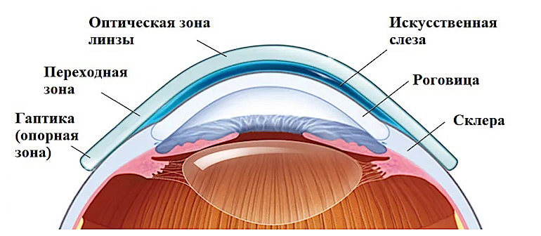 склера на глазу