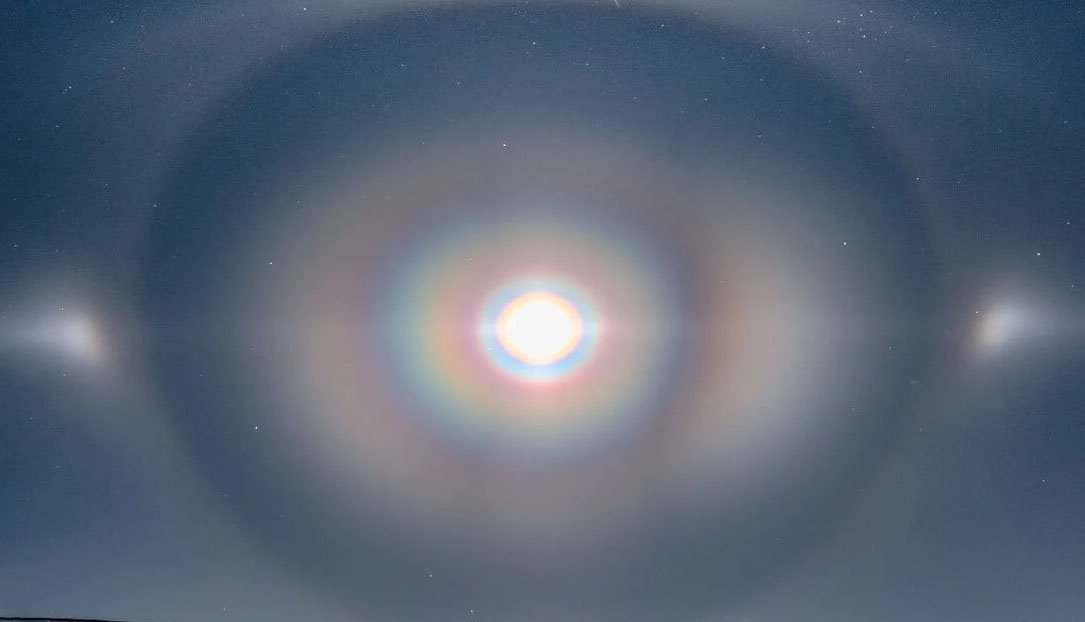 симптомы пигментной глаукомы