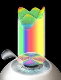 продольный микрокератом Moria